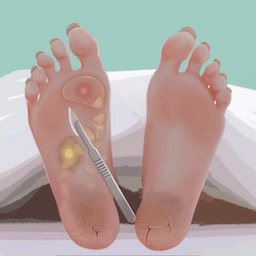 沉浸式修脚大师手机版